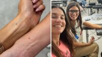 Why My Micro Fine-Line Tattoo Fell Off a Week After I Got It
